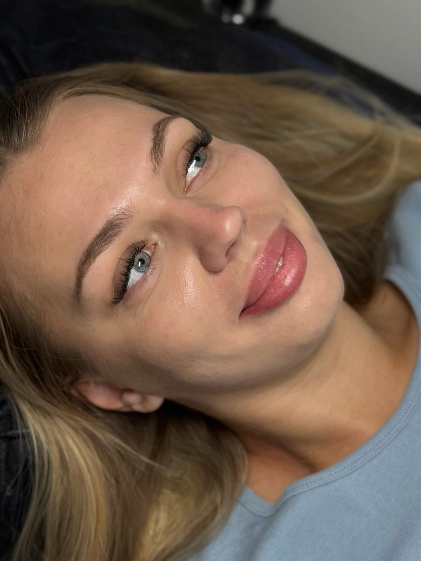 Prirodzený výsledok laminácie mihalníc